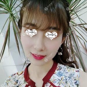 在天津耶利亚做埋线提升术后效果明显 在天津耶利亚做埋线提升术后效果明显