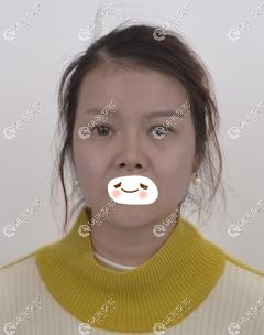 ��ǰ�沿Ƥ���ɳ�