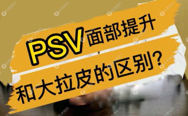 PSV沿ʹƤʲô^(q)e