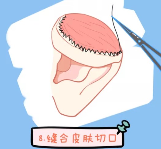 ���������Ķ����������ں��ϱ��ص��Ƽ����
